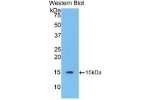 Western Blotting (WB) image for anti-Solute Carrier Family 30 (Zinc Transporter), Member 8 (SLC30A8) (AA 263-369) antibody (ABIN7435796)