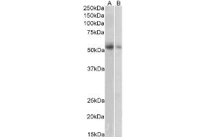 ABIN5855385 (1 µg/ml) staining of Human Placenta (A) and Human Adrenal Gland (B) lysate (35 µg protein in RIPA buffer). (SLC18A2 抗体)