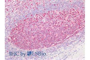 Immunohistochemistry (IHC) image for anti-Proliferating Cell Nuclear Antigen (PCNA) (AA 111-122) antibody (ABIN1049498)