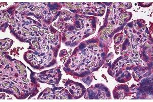Human Placenta: Formalin-Fixed, Paraffin-Embedded (FFPE) (JAM2 抗体  (AA 29-299))