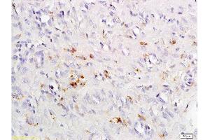 Immunohistochemistry (Paraffin-embedded Sections) (IHC (p)) image for anti-Chemokine (C-C Motif) Receptor 4 (CCR4) (AA 201-300) antibody (ABIN738666)