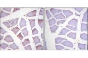 Immunohistochemistry analysis of paraffin-embedded human skeletal muscle, using XIAP (Phospho-Ser87) Antibody. (Intestinal Alkaline Phosphatase 抗体  (pSer87))