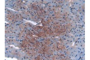 IHC-P analysis of Mouse Heart Tissue, with DAB staining. (IGF2R 抗体  (AA 1148-1365))