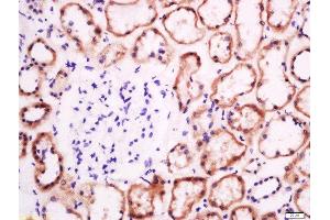 Paraformaldehyde-fixed, paraffin embedded human kidney tissue, Antigen retrieval by boiling in sodium citrate buffer(pH6) for 15min, Block endogenous peroxidase by 3% hydrogen peroxide for 30 minutes, Blocking buffer (normal goat serum) at 37°C for 20min, Antibody incubation with Rabbit Anti-EphB2 R Polyclonal Antibody, Unconjugated  at 1:200 overnight at 4°C, followed by a conjugated secondary and DAB staining (EphB2 R (AA 101-200) 抗体)