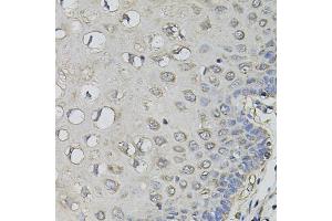 Immunohistochemistry of paraffin-embedded human esophagus using AMPD1 antibody (ABIN5995393) (40x lens). (AMPD1 抗体)