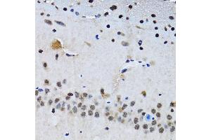 Immunohistochemistry of paraffin-embedded mouse brain using BIRC7 antibody. (BIRC7 抗体)