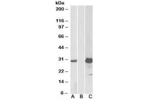 Western blot testing of HEK293 lysate overexpressing human KCTD11-FLAG with KCTD11 antibody (1ug/ml) in lane A and anti-FLAG (1/5000) in lane C. (KCTD11 抗体)