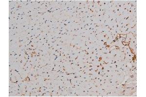 ABIN6267437 at 1/200 staining Mouse heart tissue sections by IHC-P. (RPS6KB1 抗体  (pThr229))