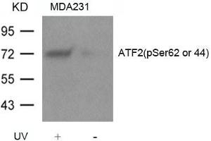 Western blot analysis of extracts from MDA231 cells untreated or treated with UV using ATF2(Phospho-Ser62 or 44) Antibody. (ATF2 抗体  (pSer62))