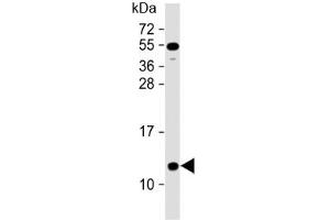 Western blot testing of human heart lysate with NDUFA2 antibody at 1:2000. (NDUFA2 抗体  (AA 62-96))