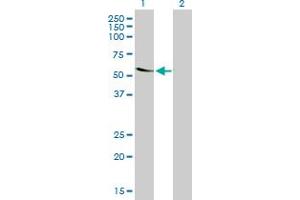 Western Blot analysis of TROVE2 expression in transfected 293T cell line by TROVE2 monoclonal antibody (M03), clone 1F2. (TROVE2 抗体  (AA 1-100))