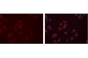 ABIN6277362 staining Hela cells by IF/ICC. (EDNRB 抗体  (C-Term))
