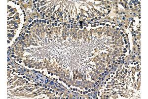 ABIN7095333 and ABIN7099390 at 1/100 staining rat testis tissue by IHC-P. (COPA 抗体)