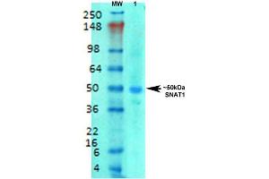 Western Blot analysis of Rat brain membrane lysate showing detection of SLC38A1 protein using Mouse Anti-SLC38A1 Monoclonal Antibody, Clone S104-32 . (SLC38A1 抗体  (AA 1-63) (Atto 390))