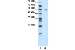 WB Suggested Anti-ZNF312  Antibody Titration: 5. (FEZF2 抗体  (C-Term))