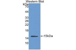 Western Blotting (WB) image for anti-Complement Factor B (CFB) (AA 270-388) antibody (ABIN1858371) (Complement Factor B 抗体  (AA 270-388))