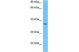 Host:  Mouse  Target Name:  PITX2  Sample Tissue:  Mouse Brain  Antibody Dilution:  1ug/ml (PITX2 抗体  (N-Term))