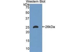 Western blot analysis of the recombinant protein. (Apolipoprotein M 抗体)