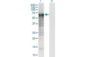 Western Blot analysis of PLS3 expression in transfected 293T cell line by PLS3 monoclonal antibody (M01), clone 5B9. (Plastin 3 抗体  (AA 1-630))