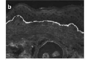 Immunofluorescence (IF) image for anti-Collagen, Type VII, alpha 1 (COL7A1) (AA 757-967) antibody (ABIN615642)