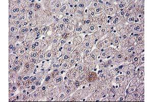 Immunohistochemical staining of paraffin-embedded Human liver tissue using anti-HAO1 mouse monoclonal antibody. (HAO1 抗体)