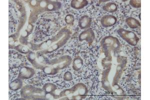 Immunostaining (ISt) image for anti-Signal Transducing Adaptor Molecule (SH3 Domain and ITAM Motif) 1 (STAM) (AA 1-403) antibody (ABIN563522)