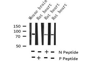 Western blot analysis of Phospho-PKC alpha (Thr638) expression in various lysates (PKC alpha 抗体  (pThr638))