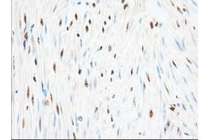 Immunohistochemical staining of paraffin-embedded Human pancreas tissue using anti-H6PD mouse monoclonal antibody. (Glucose-6-Phosphate Dehydrogenase 抗体)