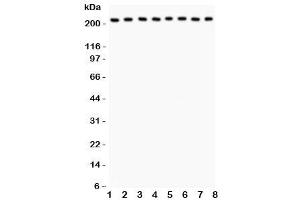 Western blot testing of Integrin alpha 5 antibody and Lane 1:  rat brain (ITGA5 抗体  (AA 787-992))