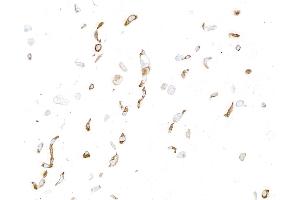 Immunocytochemistry (ICC) image for anti-Oxidized Low Density Lipoprotein (Lectin-Like) Receptor 1 (OLR1) (AA 61-273) antibody (ABIN7795657)