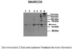 Western Blotting (WB) image for anti-SWI/SNF Related, Matrix Associated, Actin Dependent Regulator of Chromatin, Subfamily D, Member 3 (SMARCD3) (N-Term) antibody (ABIN2776387)