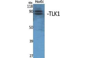 Western Blotting (WB) image for anti-Tousled-Like Kinase 1 (TLK1) (Internal Region) antibody (ABIN3187282) (TLK1 抗体  (Internal Region))