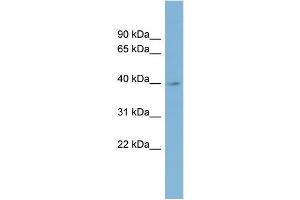 WB Suggested Anti-IMPAD1 Antibody Titration:  0. (IMPAD1 抗体  (Middle Region))