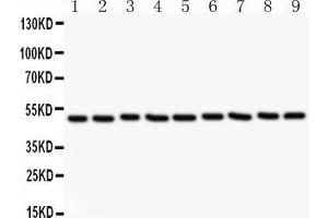 Anti-CSK Picoband antibody, All lanes: Anti CSK  at 0. (CSK 抗体  (AA 2-204))