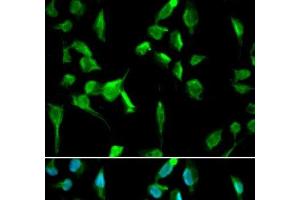 Immunofluorescence analysis of A549 cells using TOPBP1 Polyclonal Antibody (TOPBP1 抗体)