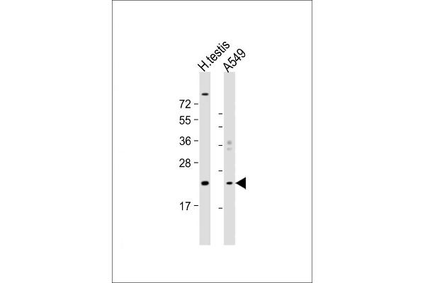 HSPB9 anticorps  (AA 70-96)