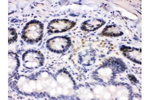 Immunohistochemistry (IHC) image for anti-Cyclin-Dependent Kinase 4 (CDK4) (AA 201-303) antibody (ABIN3043745)