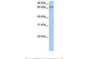 Image no. 1 for anti-Poly(A) Binding Protein, Cytoplasmic 4 (Inducible Form) (PABPC4) (AA 432-481) antibody (ABIN6737931) (PABPC4 抗体  (AA 432-481))