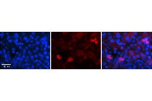 Rabbit Anti-NRF1 Antibody    Formalin Fixed Paraffin Embedded Tissue: Human Adult liver  Observed Staining: Nuclear and some weak cytoplasmic Primary Antibody Concentration: 1:600 Secondary Antibody: Donkey anti-Rabbit-Cy2/3 Secondary Antibody Concentration: 1:200 Magnification: 20X Exposure Time: 0.