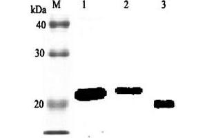 Western blot analysis using anti-RBP4 (rat), pAb  at 1:2'000 dilution. (RBP4 抗体)