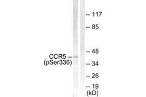 Western blot analysis of extracts from Jurkat cells, using CCR5 (Phospho-Ser336) Antibody. (CCR5 抗体  (pSer336))