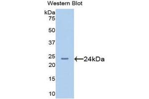 Western Blotting (WB) image for anti-Afamin (AFM) (AA 210-403) antibody (ABIN1077755) (Afamin 抗体  (AA 210-403))