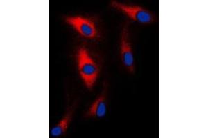 Immunofluorescent analysis of MAST2 staining in HeLa cells. (MAST2 抗体  (Center))