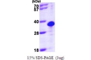 SDS-PAGE (SDS) image for Thiamine Triphosphatase (THTPA) (AA 1-230) protein (His tag) (ABIN667184)