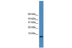 WB Suggested Anti-KIAA0101 Antibody Titration:  0. (KIAA0101 抗体  (N-Term))