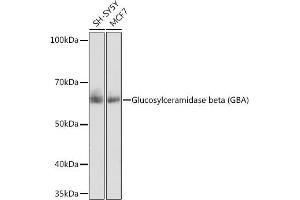 Western blot analysis of extracts of various cell lines, using Glucosylceramidase beta (Glucosylceramidase beta (GBA)) antibody (ABIN7267407) at 1:1000 dilution. (GBA 抗体)