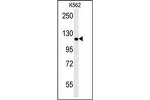 Western blot analysis of POTEE Antibody (Center) in K562 cell line lysates (35ug/lane). (POTEE 抗体  (Middle Region))