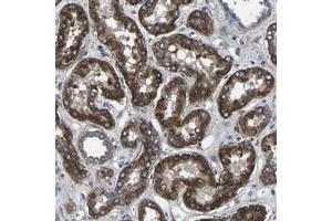 Immunohistochemical staining of human kidney with KIAA1958 polyclonal antibody  shows strong cytoplasmic positivity tubular cells. (KIAA1958 抗体)