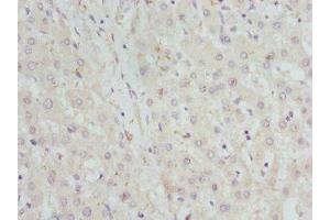 Immunohistochemistry of paraffin-embedded human liver tissue using ABIN7142066 at dilution of 1:100 (GBE1 抗体  (AA 1-300))