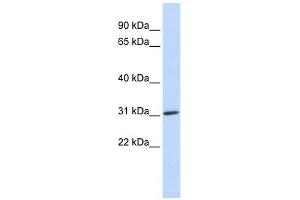ARD1A antibody used at 1 ug/ml to detect target protein. (NAA10 抗体)